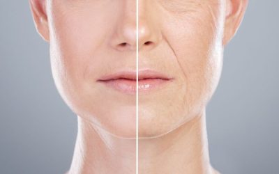 Cuál es la mejor crema antiarrugas