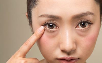 Diferencias entre ojeras y bolsas