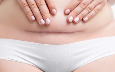 Fases de la cicatrización