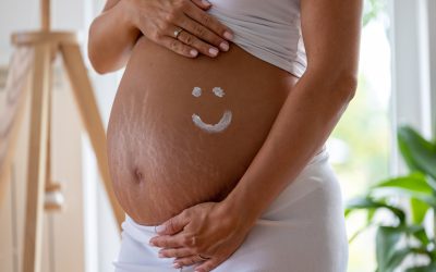 Estrías en el embarazo: prevención y tratamiento efectivo